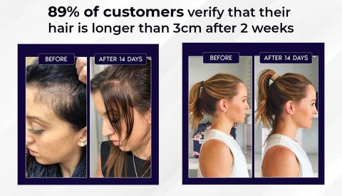 NaturaRevive Hair Spray - 5x Faster Hair Growth + 50% OFF
