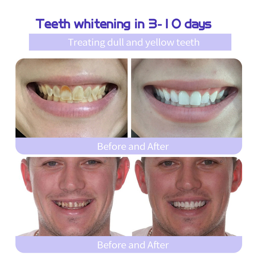 The RestoreGum Mineral Powder - Dentist-Approved, TGA Recommended for Gum &amp; Tooth Repair + 50% OFF