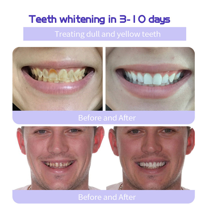 The RestoreGum Mineral Powder - Dentist-Approved, TGA Recommended for Gum &amp; Tooth Repair + 50% OFF
