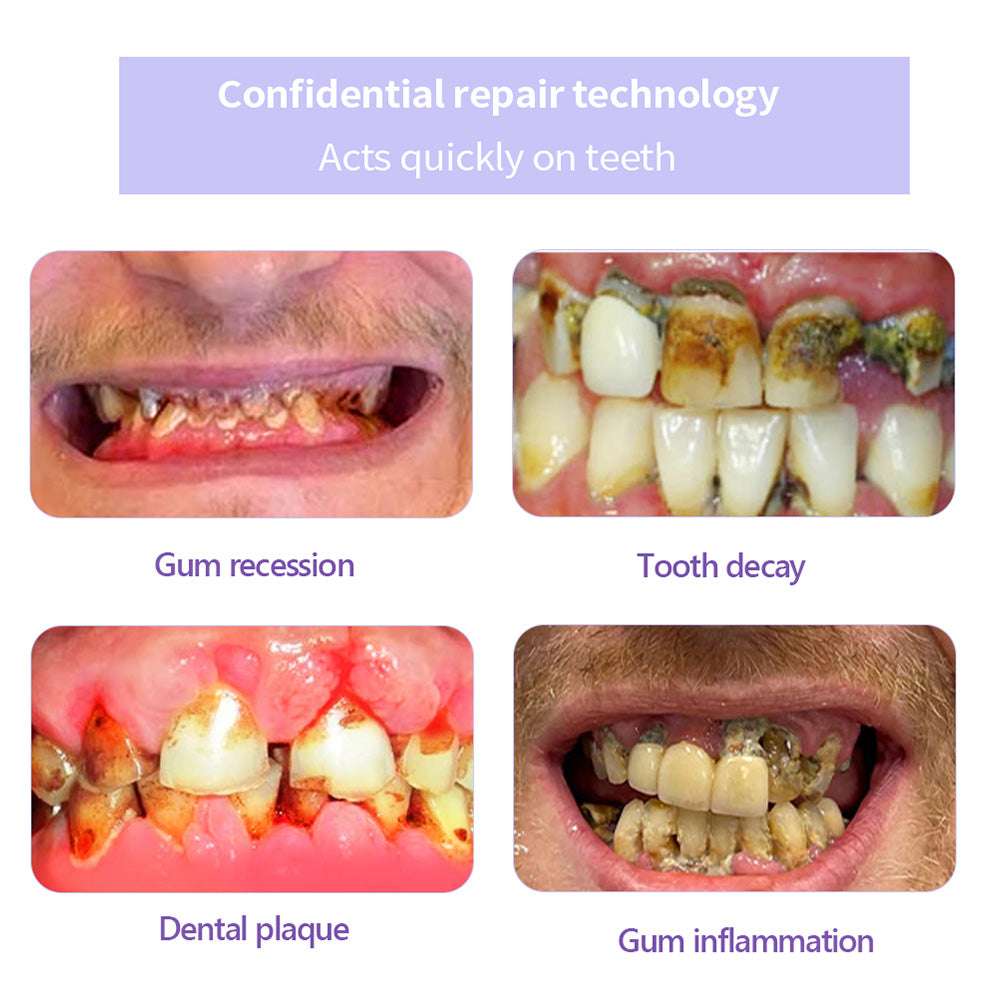 Odalit – Rebuild Gums &amp; Save Teeth + 50% OFF