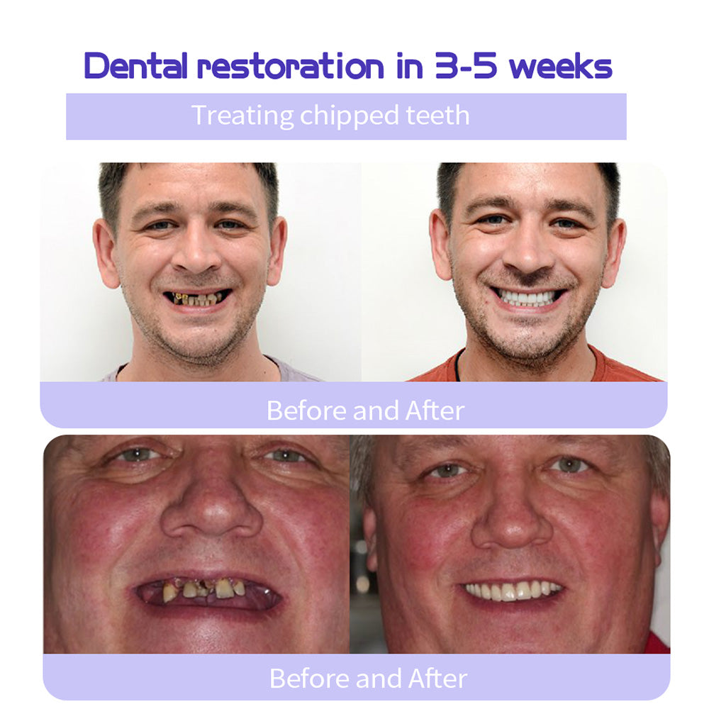 The RestoreGum Mineral Powder - Dentist-Approved, TGA Recommended for Gum &amp; Tooth Repair + 50% OFF