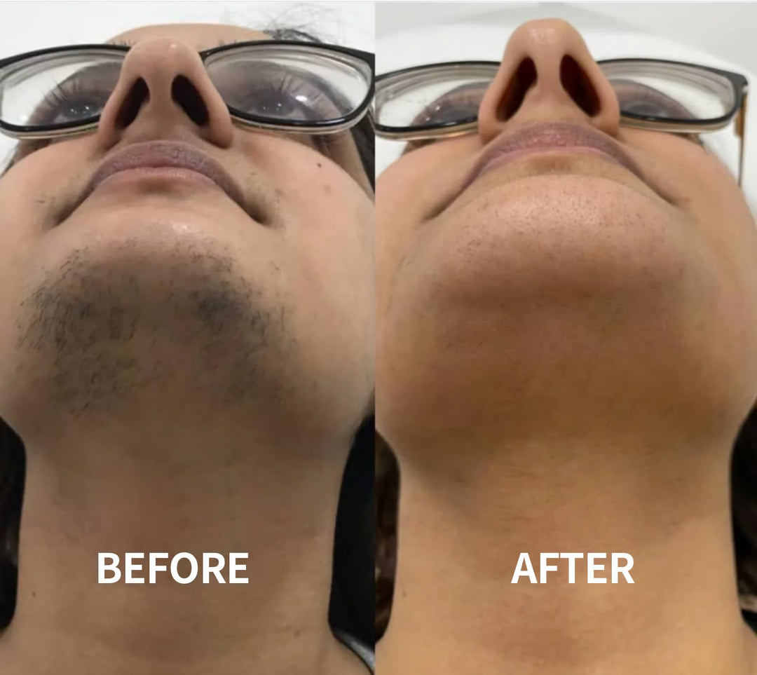 Petalune™ – Gentle Painless Facial Hair Removal Cream with Shea Butter &amp; Centella + 1+1 FREE