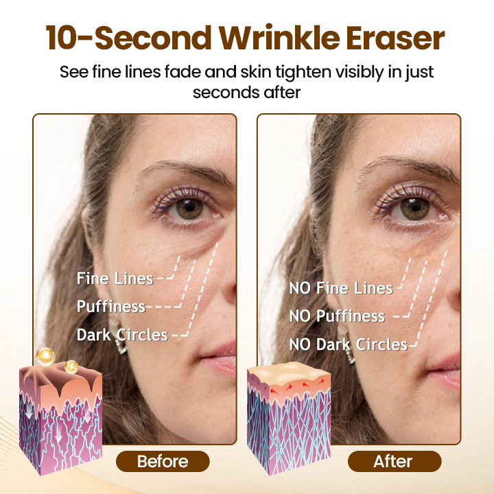 Lovelift - Reverse Aging in 10 Seconds + 50% OFF