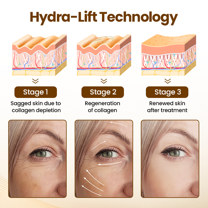 Lovelift - Reverse Aging in 10 Seconds + 50% OFF