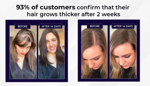 NaturaRevive Hair Spray - 5x Faster Hair Growth + 50% OFF