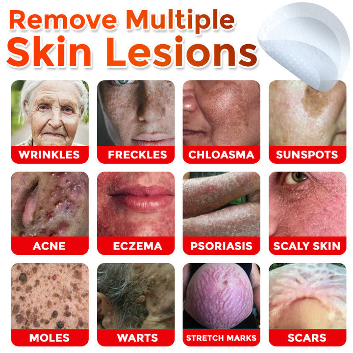 The MicroDerm Patch - Painless Skin Tag &amp; Blemish Removal + 50% OFF