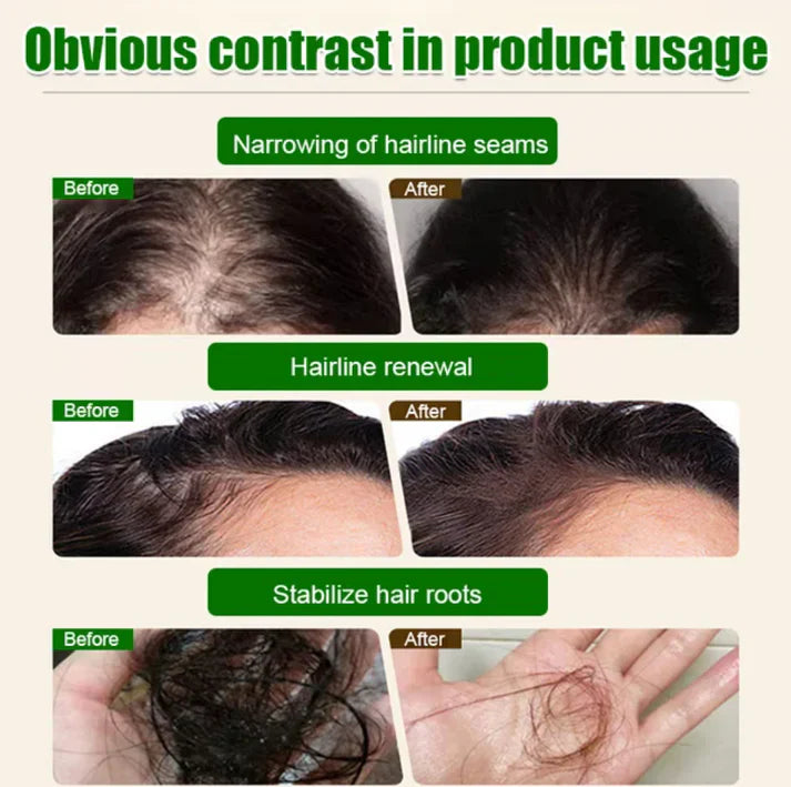 The AuraRoot Batana Oil — 100% Pure Formula for Natural Hair Growth - 50% OFF