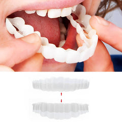 LuminaSmile Instant Confidence Veneers - 50% OFF