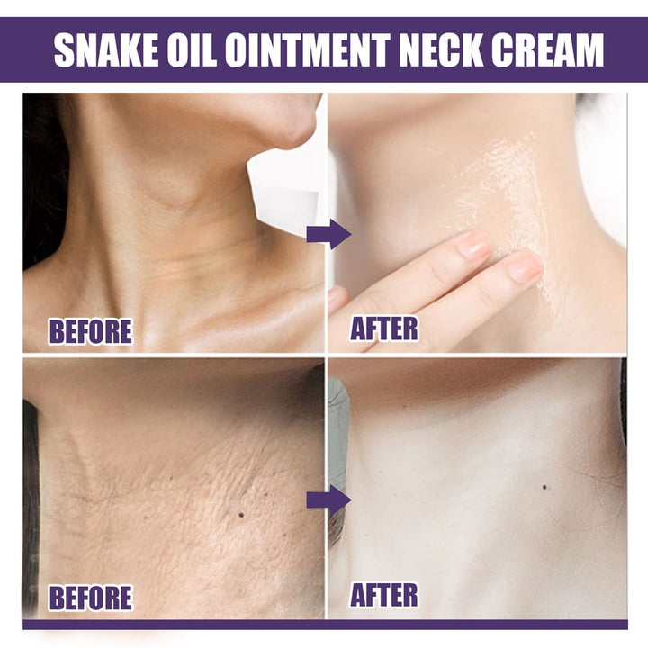 LiftaGlow Sculpt – Erase neck "rings" &amp; tighten sagging skin. 50% OFF