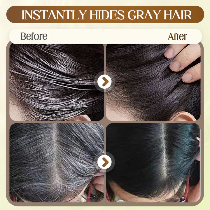 SilverVanish Pro - 10-Year Younger Look Instantly - 50% OFF