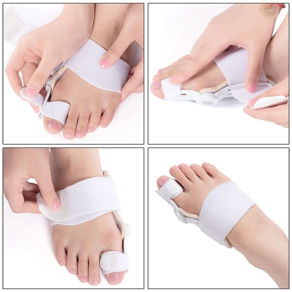 Solea™ – Adjustable Hinged Bunion Corrector with Soft Metatarsal Pad + 50% OFF